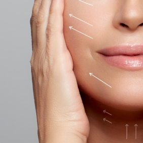 リフトアップ効果