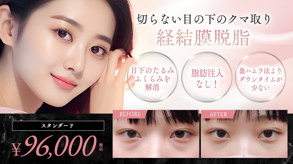 切らない目の下のクマ取り（経結膜脱脂）