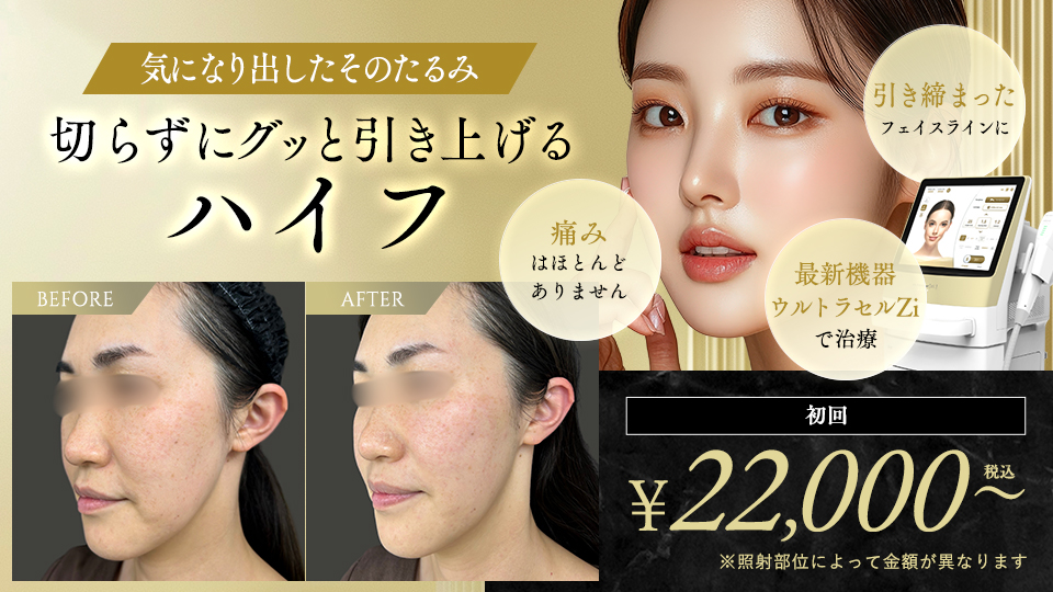 ハイフ（ウルトラセルZi）