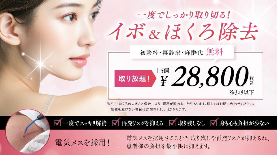 ホクロ取り/イボ取り