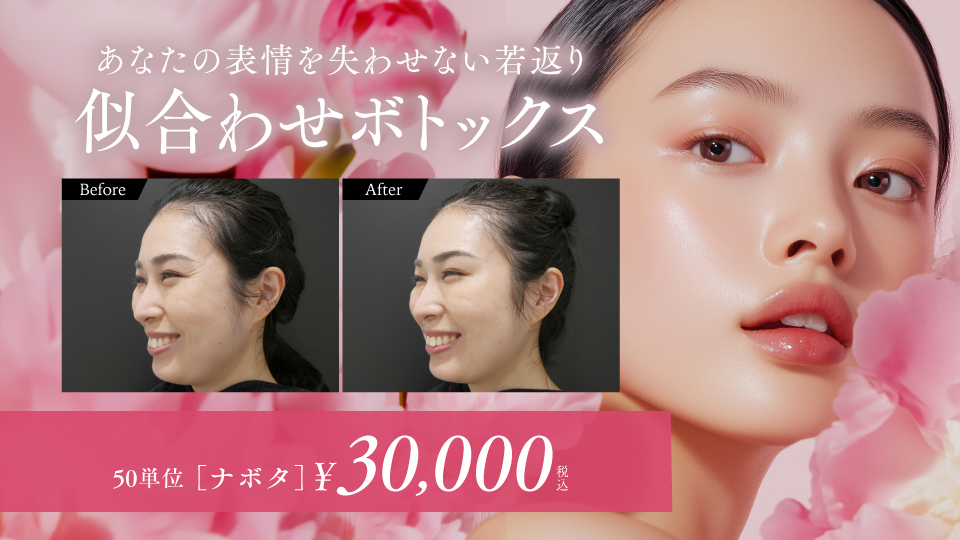 似合わせボトックス