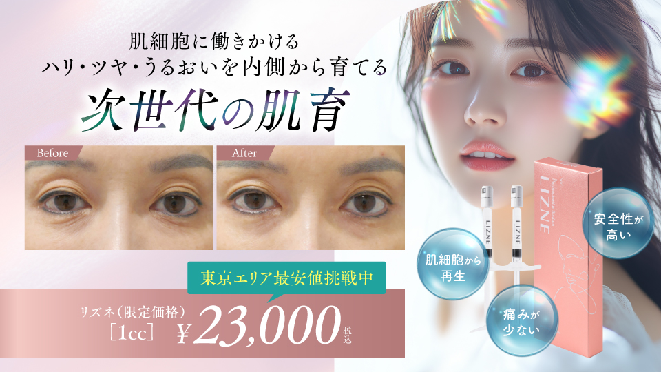 リズネ（リジュランの改良版）