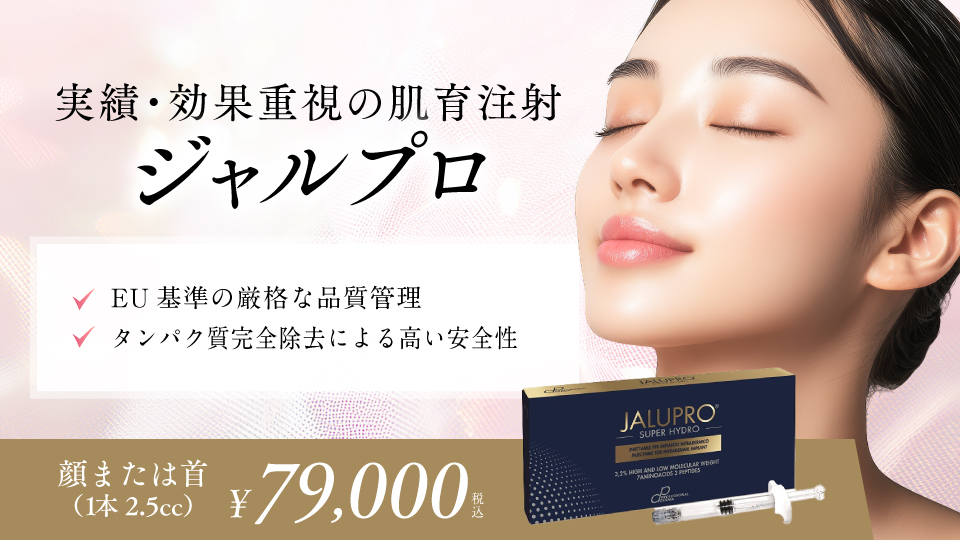 ジャルプロ（JALUPRO）